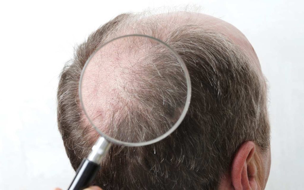 hair cloning