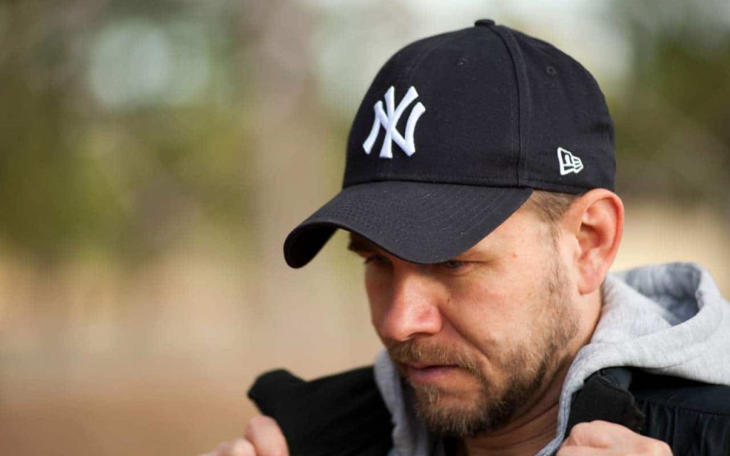 hat hair loss