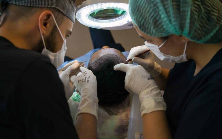 hair transplant surgery