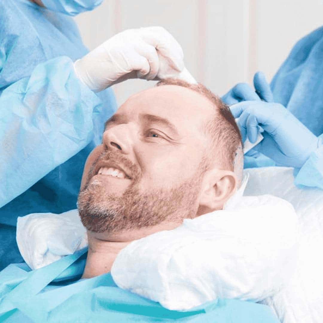 Men's hair transplants, patient result at UK Hair Transplant Clinics